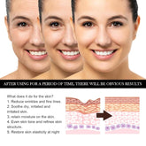 2pcs Lalena Rosehip Oil, Castor Oil Black Seed Oil Rosehip Oil Face Serum, Lilinas Castor Oil Black Seed Oil Rosehip Oil Face Serum, Natural Skincare